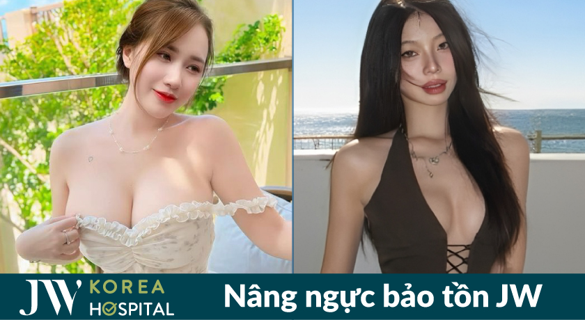 Nâng ngực bảo tồn tại bệnh viện JW giúp vòng 1 căng tròn, quyến rũ 