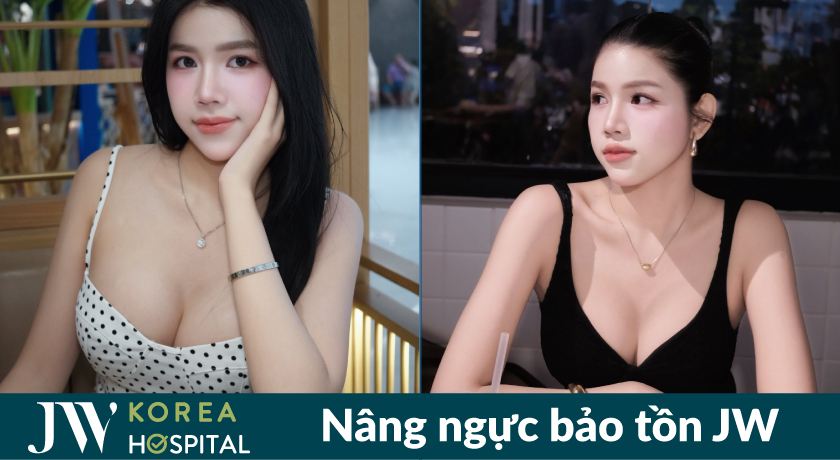 Ngực căng tròn, quyến rũ với nâng ngực bảo tồn tại bệnh viện JW 