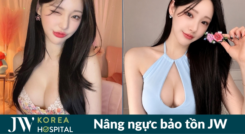 Hàng trăm khách hàng tin chọn nâng ngực bảo tồn tại bệnh viện JW 