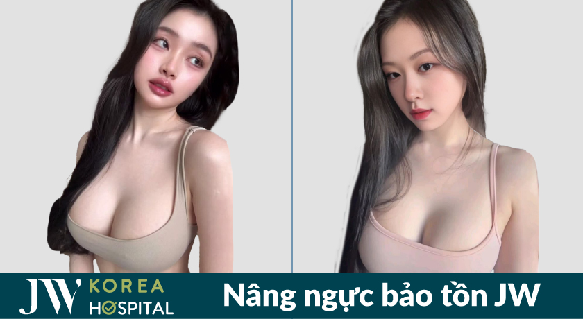 Nâng ngực bảo tồn tại bệnh viện JW giúp sở hữu dáng ngực tự nhiên, mềm mại 