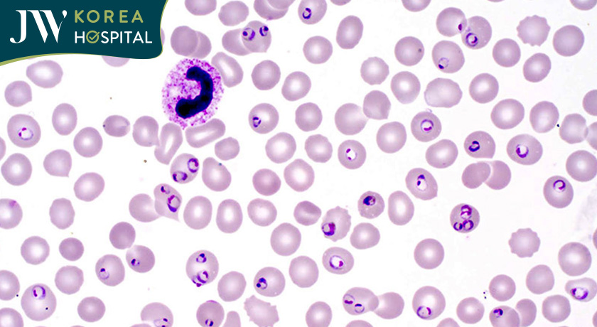 Ký sinh trùng Plasmodium gây bệnh truyèn nhiễm 