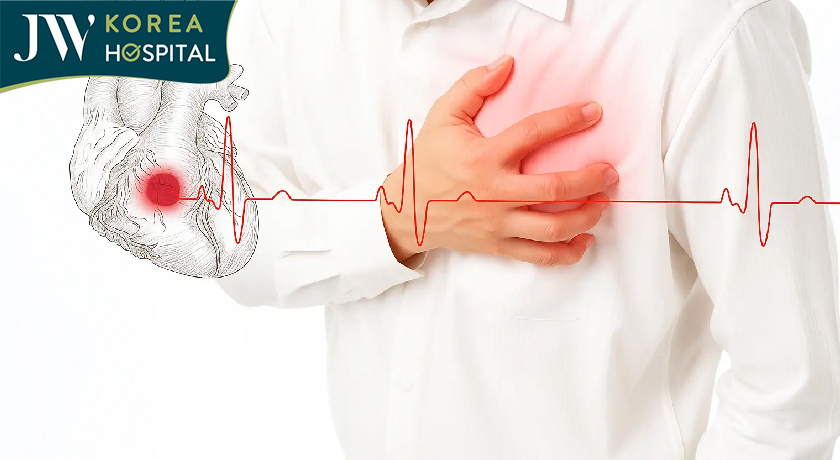 Đau thắt tim dữ dội dấu hiệu của đột quỵ