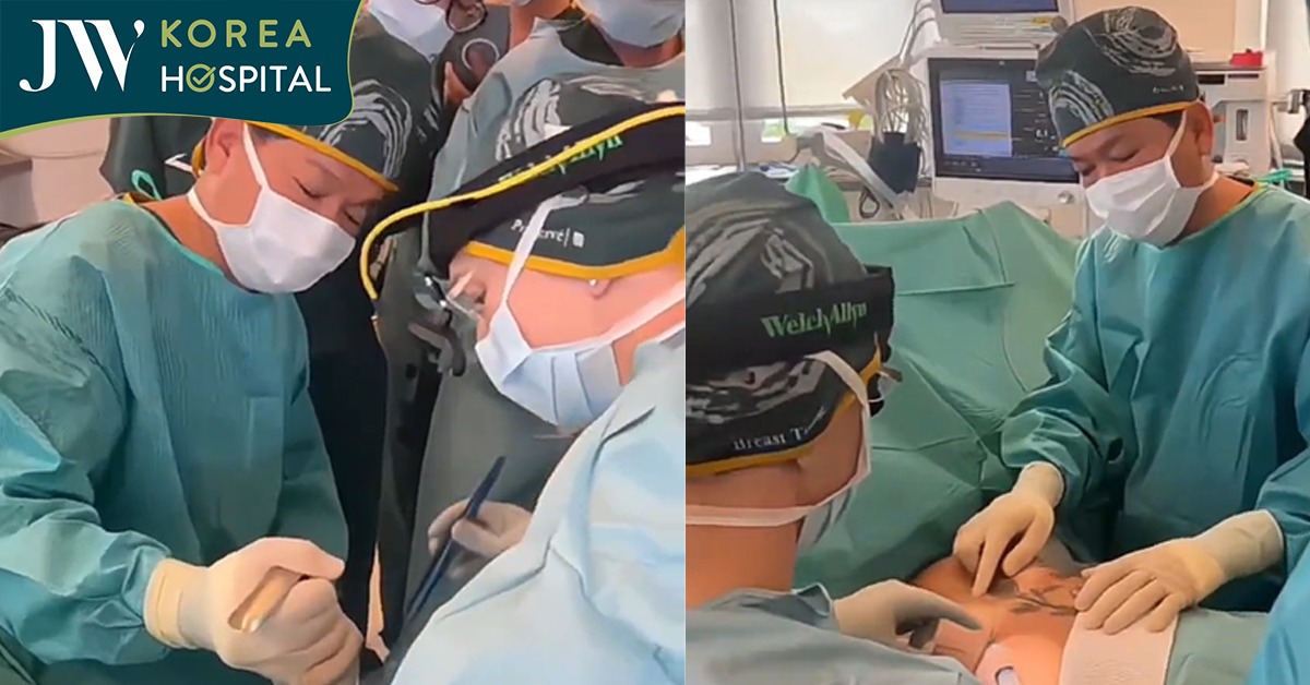 Bác sĩ Tú Dung nâng ngực Ergonomix 2: Xu hướng nâng vòng 1 được khách hàng quan tâm nhất 2026
