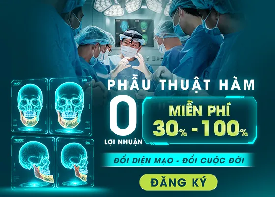 Ưu đãi phẩu thuật hàm 0 lợi nhuận