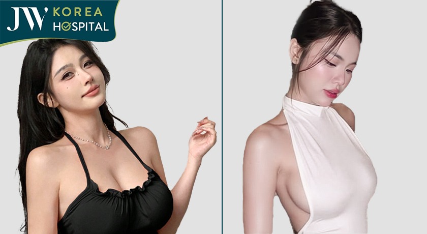 Nâng ngực bảo tồn dành cho phụ nữ muốn sở hữu vòng 1 mềm mại tự nhiên mà không cần thời gian nghỉ dưỡng lâu ngày 