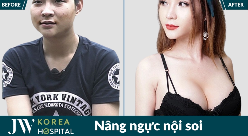 Nâng ngực nội soi tại Bệnh viện JW được thực hiện trong phòng mổ vô trùng, an toàn, đạt chuẩn y khoa