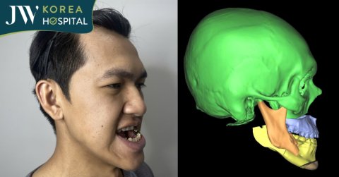 Phẫu thuật ảo 3D: Vì sao ca phẫu thuật hàm mặt của Soda phải “mổ thử” trước trên phần mềm?