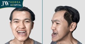 Soda Camp vượt biên đến Việt Nam phẫu thuật hàm 2 lần tại Bệnh viện JW
