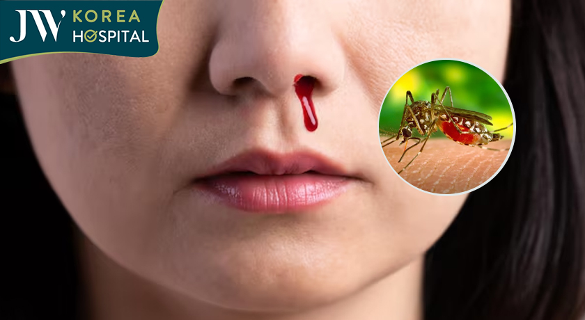 chảy máu bất thường do sốt xuất huyết