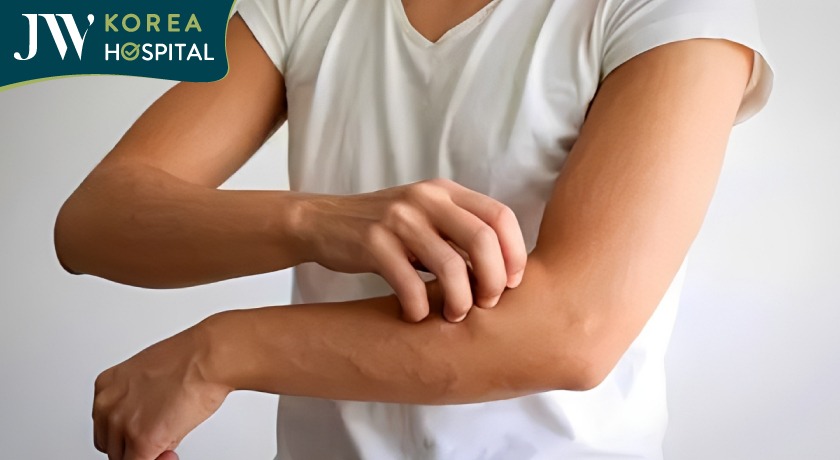 do tích tụ chất bẩn dưới da nên dẫn đến ngứa do ung thư gan