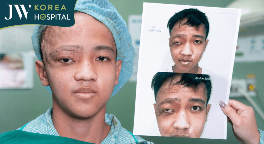 Kết quả phẫu thuật cắt u mặt máu và căng da trán