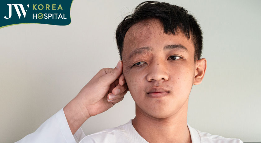 Nam sinh 16 tuổi mắc khối u máu bẩm sinh được bác sĩ chuyên khoa tại JW trực tiếp thăm khám và đánh giá tình trạng 