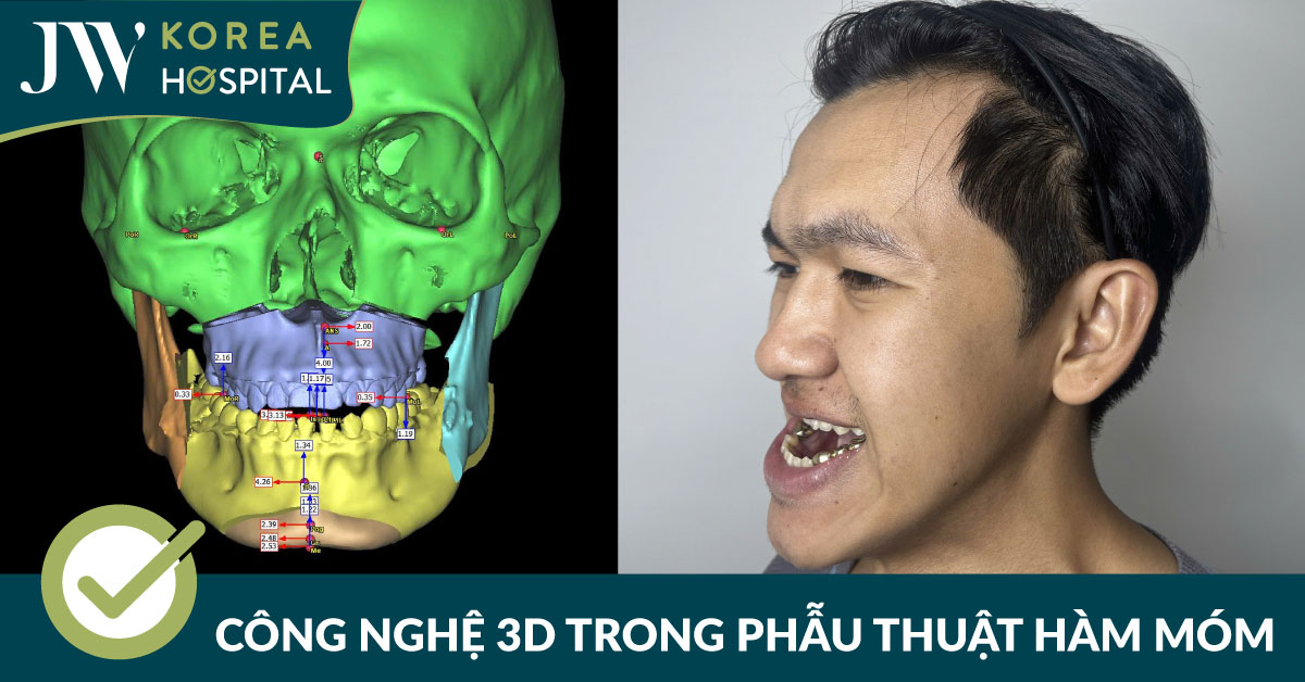 Từ dữ liệu 3D đến kết quả sau mổ: Dấu ấn công nghệ số trong phẫu thuật hàm mặt tại JW
