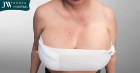 vòng 1 phình to 115cm vì mỡ nhân tạo