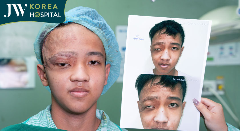 Diện mạo nam sinh 16 tuổi sau phẫu thuật tạo hình phục hồi xử lý di chứng u máu bẩm sinh