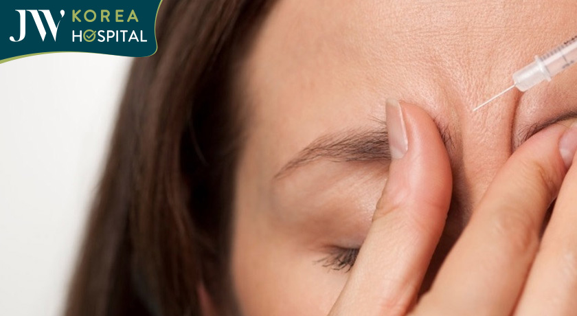 Tiêm botox để xóa cau mày là cách phổ biến nhiều người áp dụng nhưng không hiệu quả dài lâu