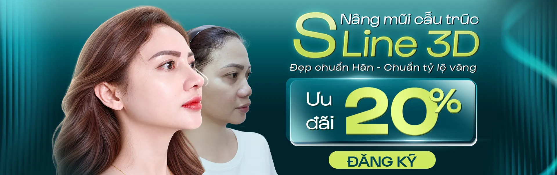 Ưu đãi nâng mũi S Line tại bệnh viện JW