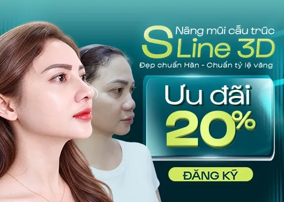 Giảm ngay 20% cho Nâng mũi cấu trúc S-line 3D