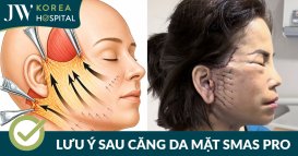 Căng da mặt SMAS PRO có đau không? Bao lâu hết sưng và hồi phục nhanh