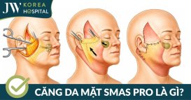 Căng da mặt SMAS PRO là gì? Cần lưu ý gì khi thực hiện căng da mặt SMAS PRO