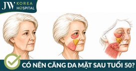 Sau 50 tuổi có nên chọn căng da mặt SMAS PRO không? Vì sao