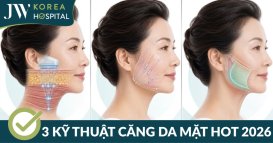 So sánh 3 phương pháp căng da mặt hot nhất 2026. Đâu là giải pháp phù hợp?