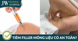 Tiêm filler mông có an toàn không? Nên tiêm bao nhiêu thì được