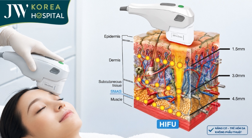 Trẻ hóa gương mặt bằng công nghệ Hifu SMAS tại bệnh viện JW