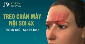 Treo chân mày nội soi 4X trẻ 20 tuổi sẹo vô hình
