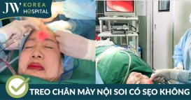 Treo chân mày nội soi là gì? Có để lại sẹo sau phẫu thuật không?