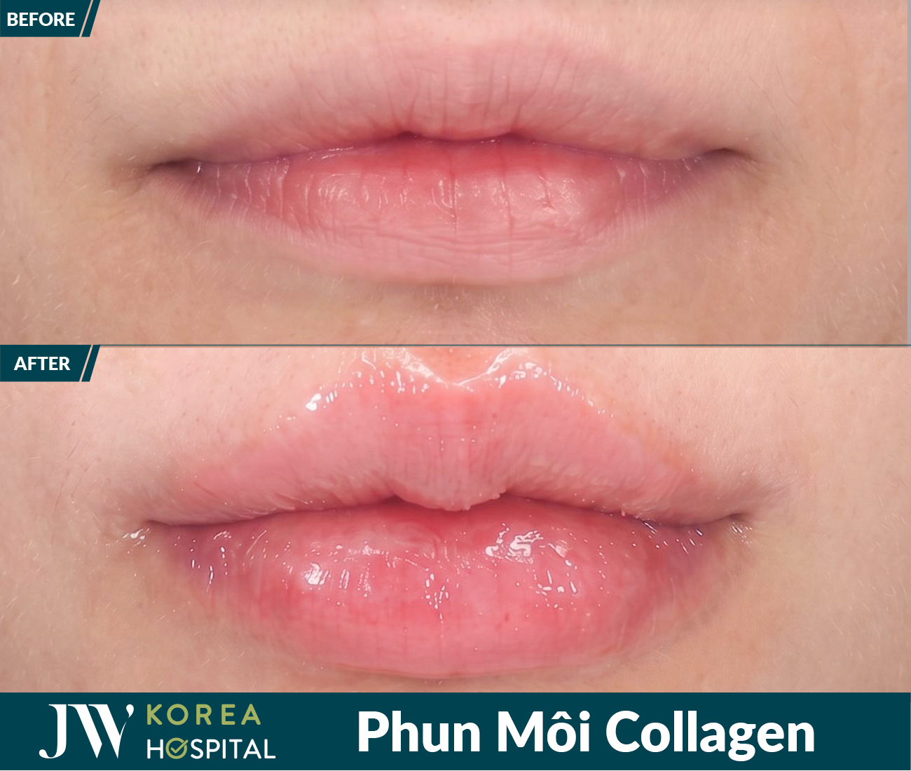 Phun xâm thẩm mỹ