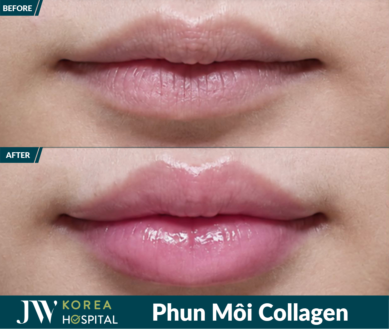 Phun xâm thẩm mỹ