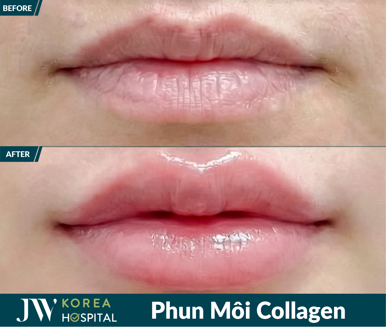 Phun xâm thẩm mỹ