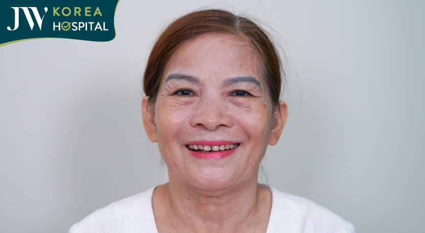 boc rang su tai benh vien jw 2 458x251