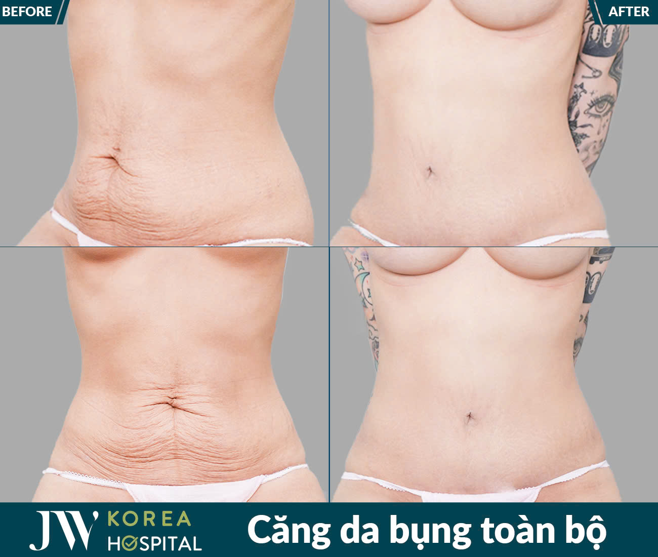 Dịch vụ giảm béo