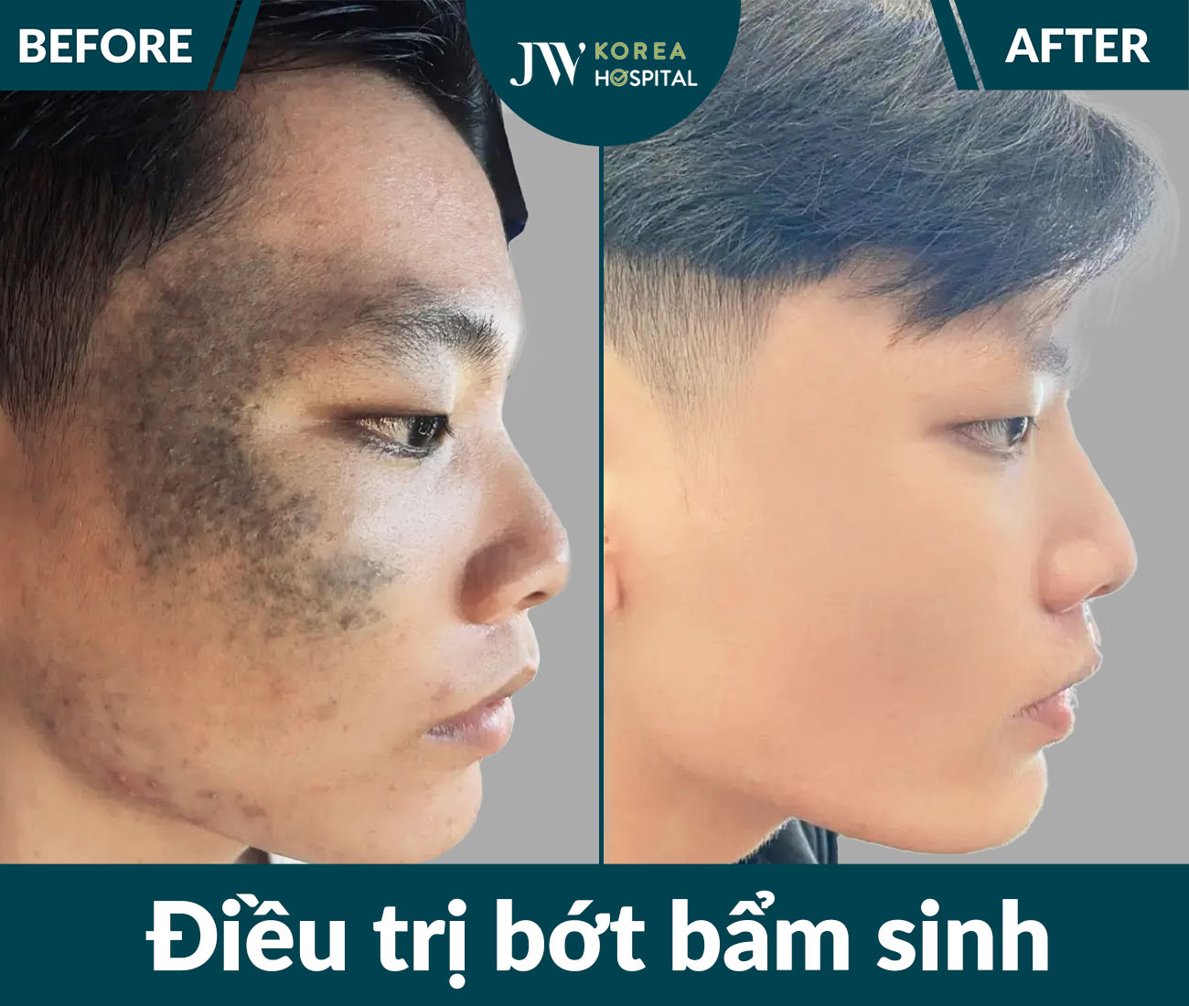 Điều trị da