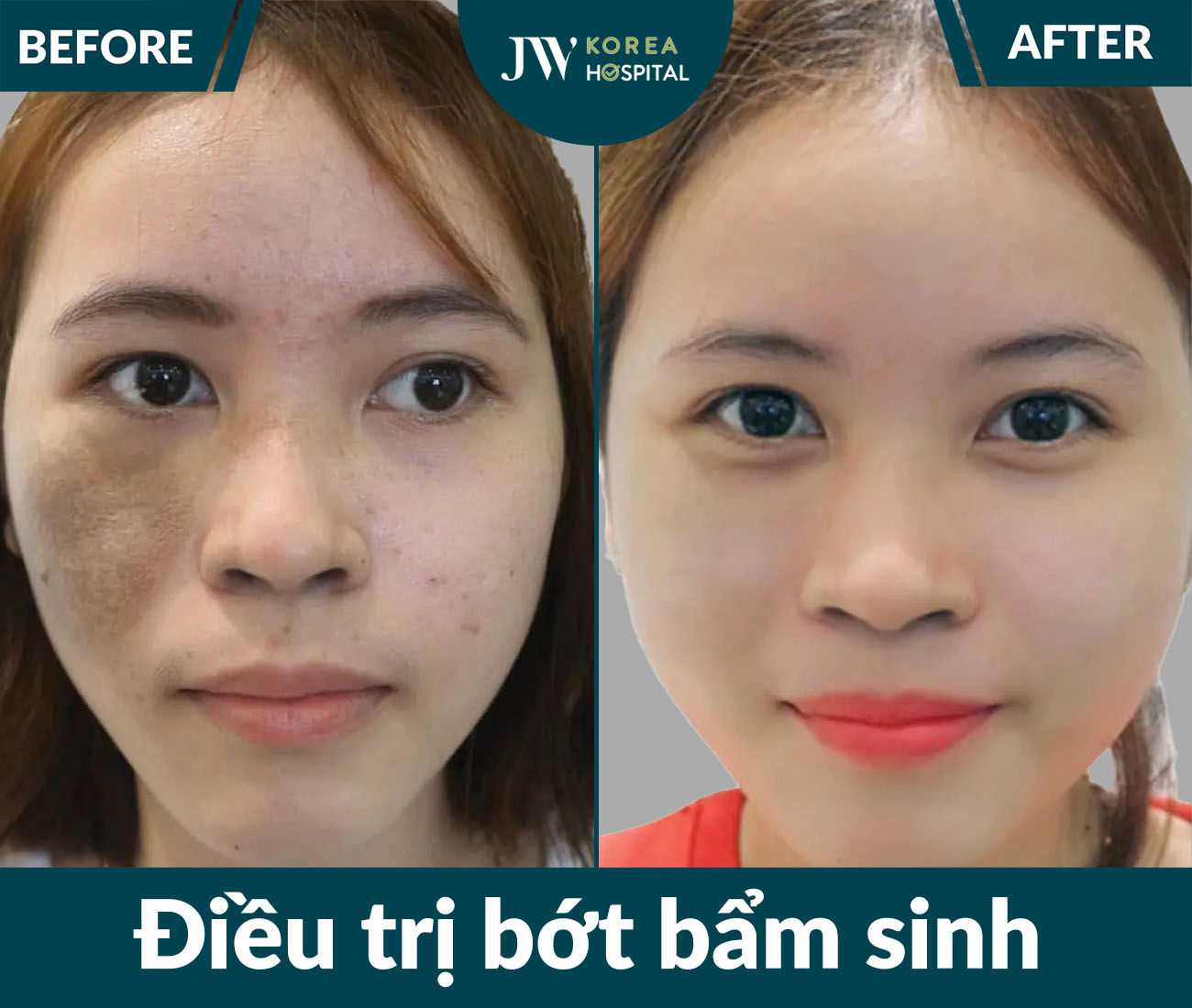 Điều trị da