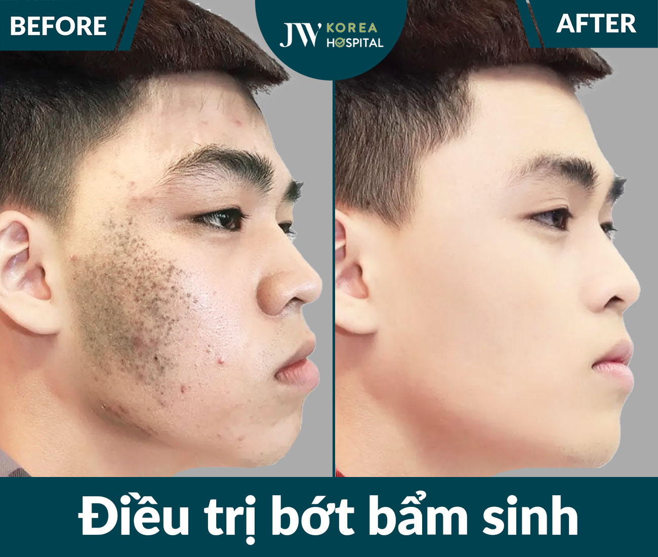 Điều trị da