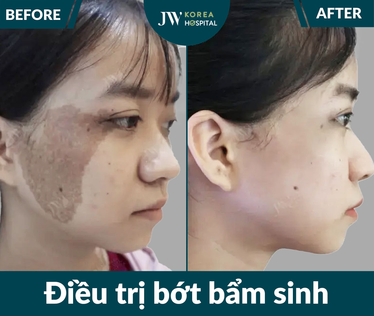 Điều trị da