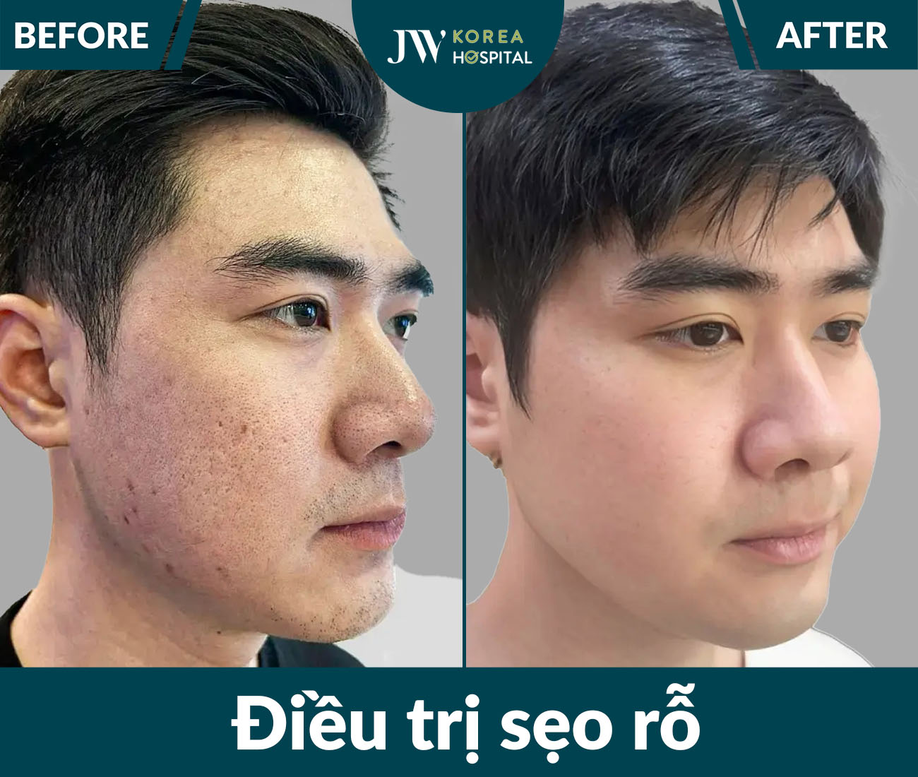 Điều trị da