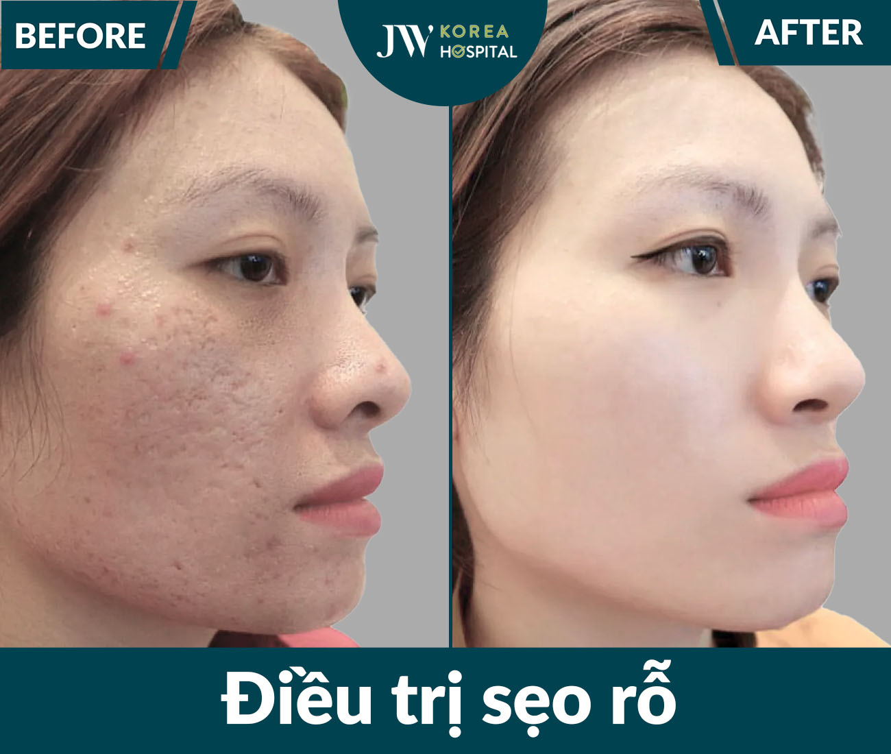 Điều trị da