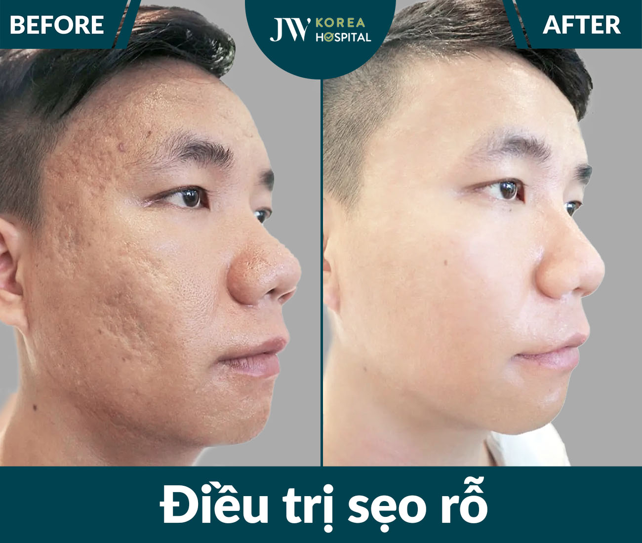 Điều trị da