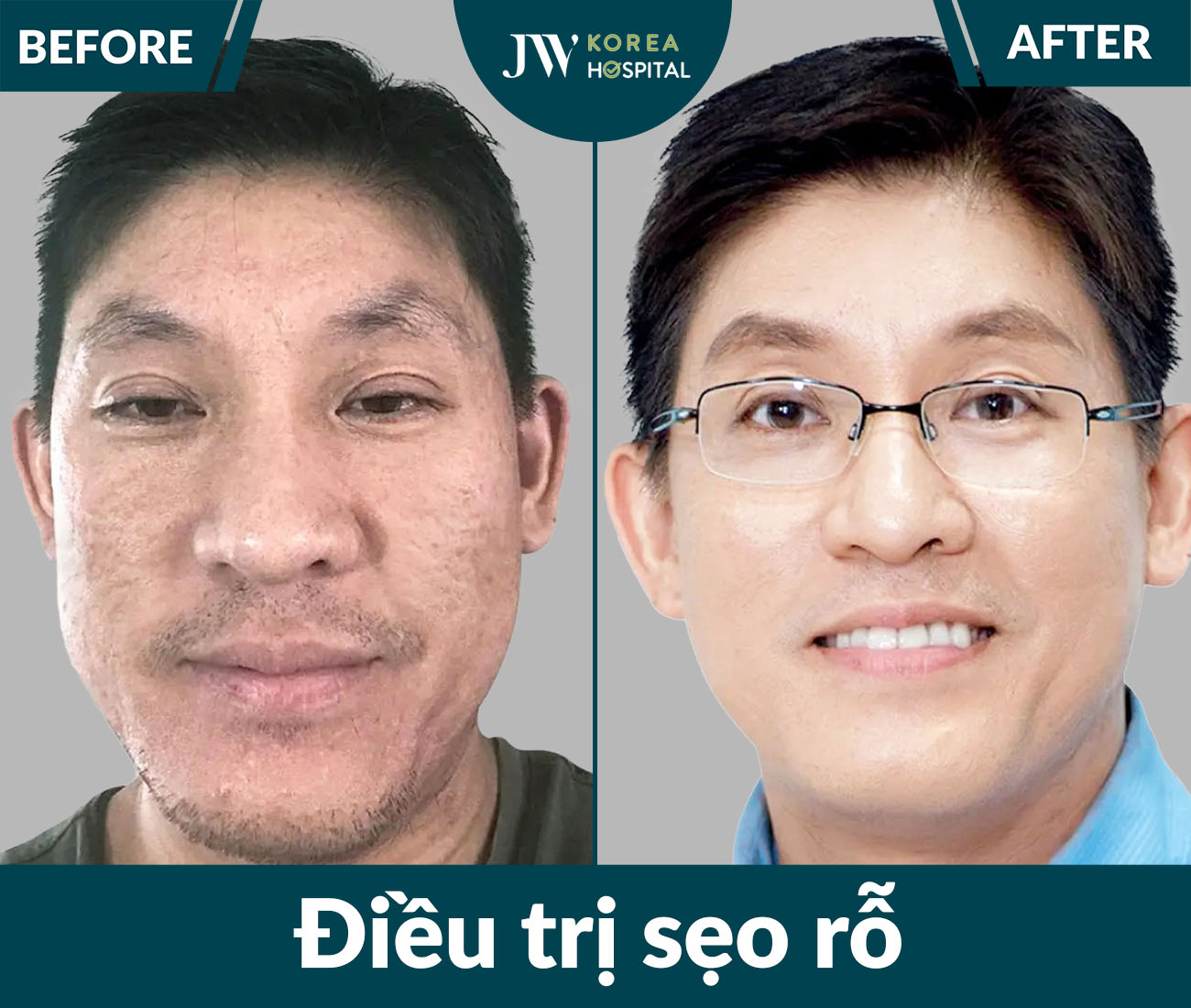 Điều trị da