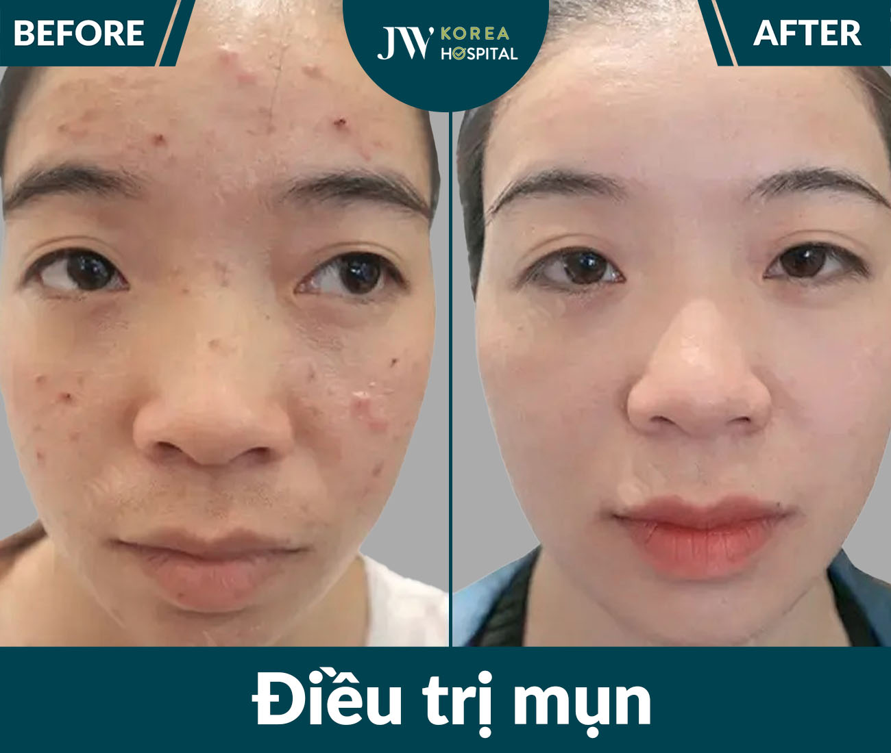 Điều trị da