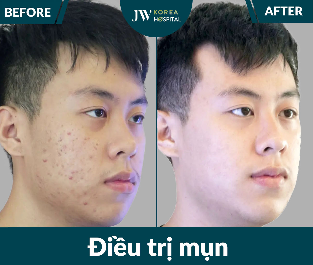 Điều trị da