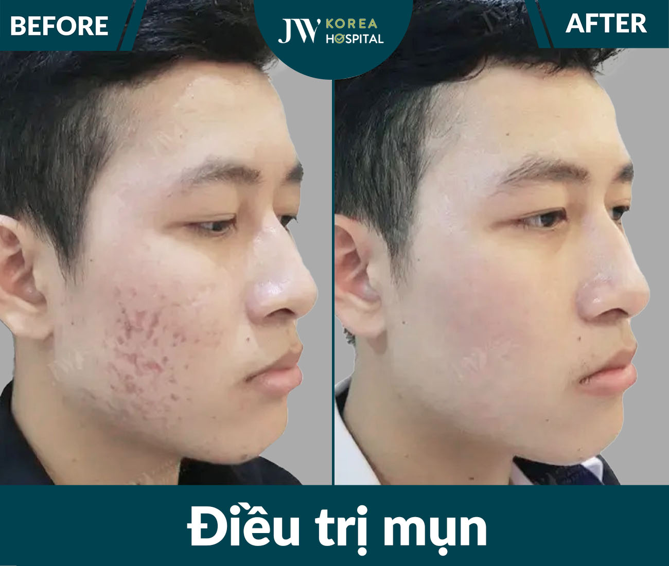 Điều trị da