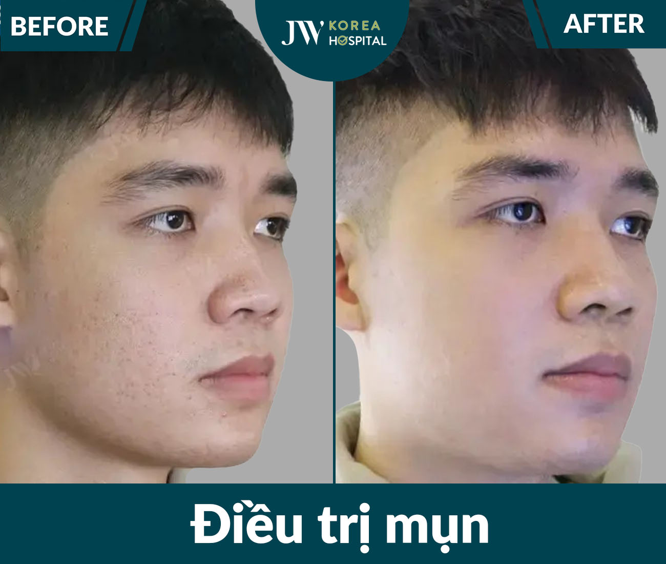 Điều trị da