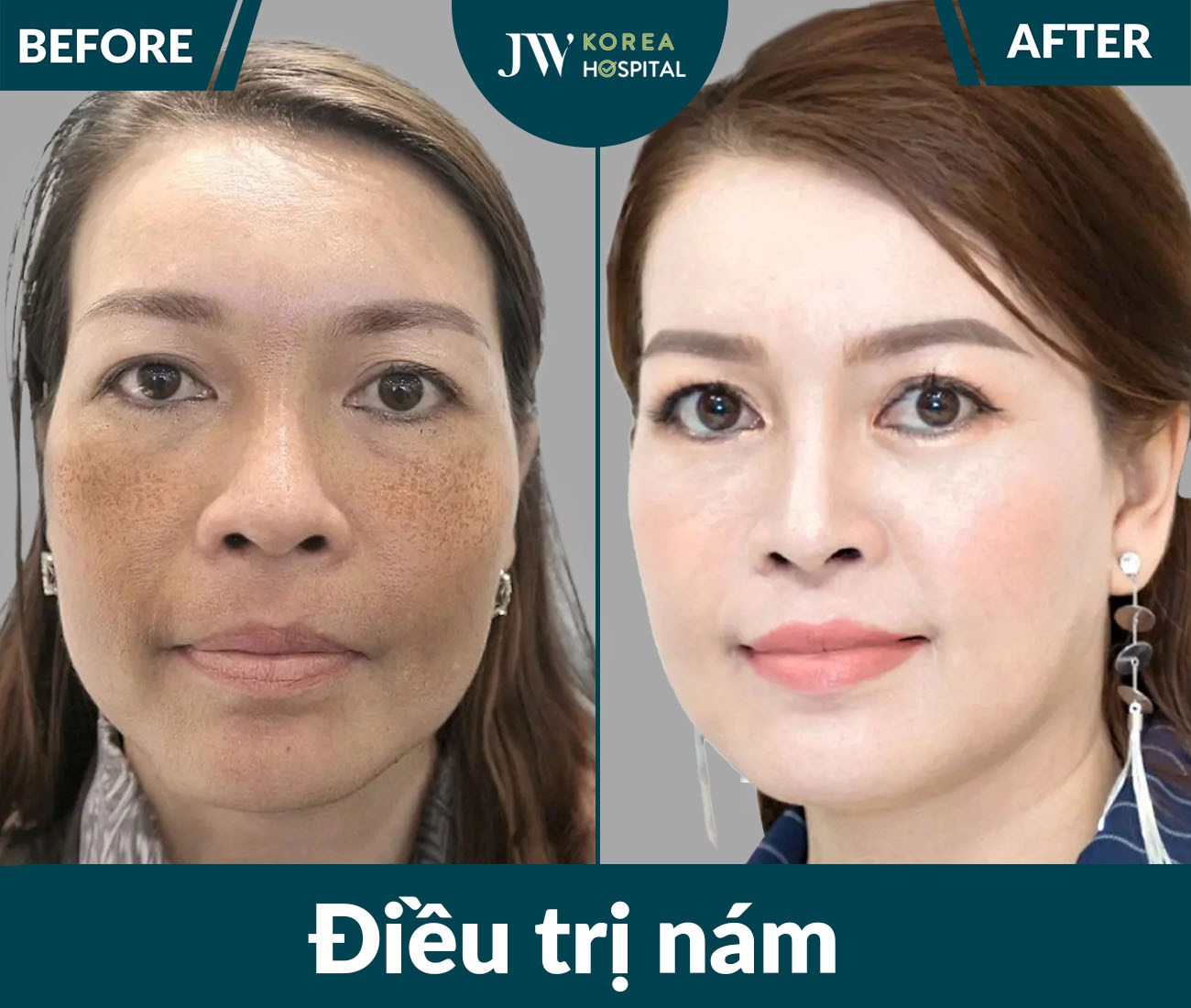 Điều trị da