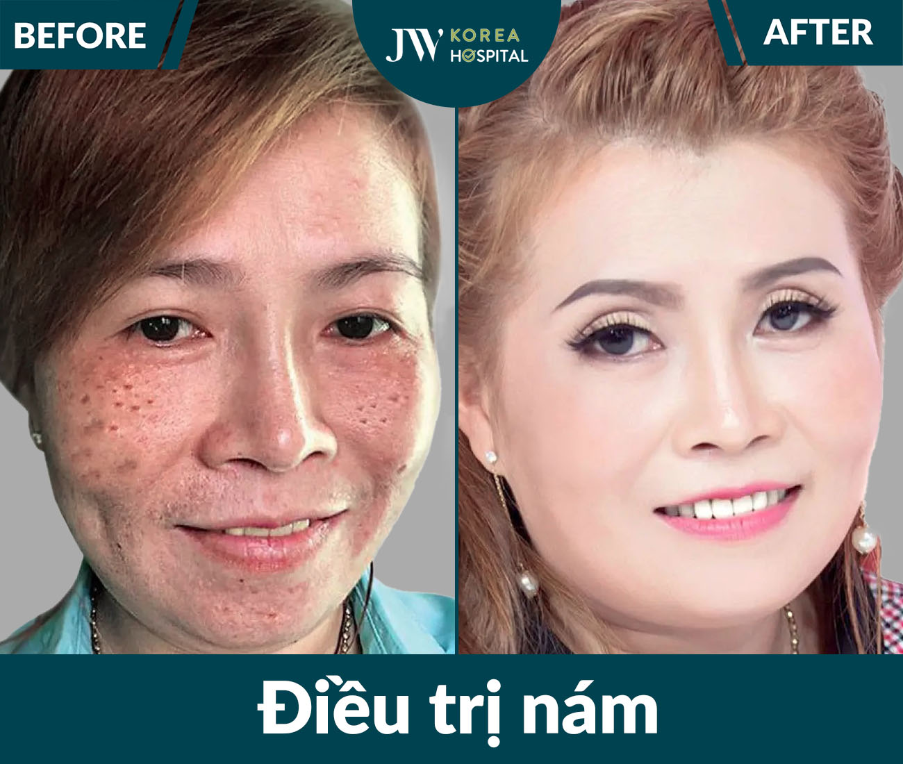 Điều trị da