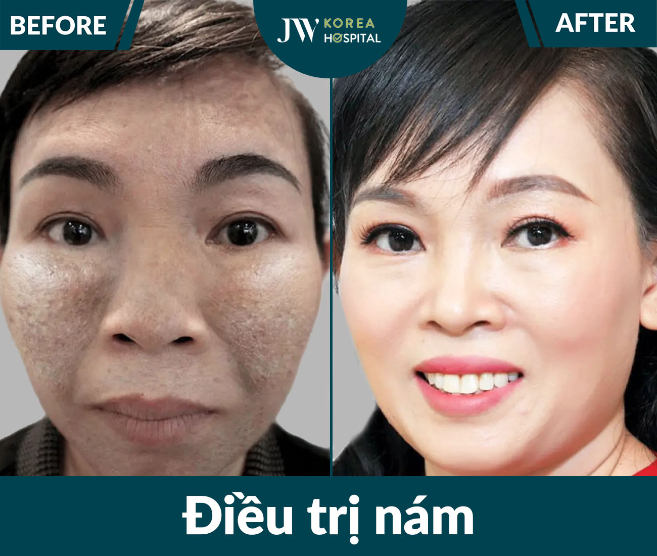 Điều trị da